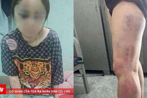 Công an vào cuộc điều tra vụ người phụ nữ tố bị 'chồng hờ' bạo hành