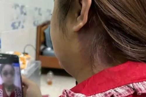 Thông tin mới nhất vụ cô gái bị chồng sắp cưới bạo hành suốt 13 tiếng gây tổn thương nghiêm trọng