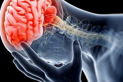 Vì sao cần phục hồi chức năng sau chấn thương sọ não?
