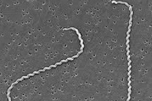 Suýt mất mạng do nhiễm Leptospira - hiểm họa từ chuột, ai dễ mắc?