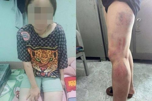 Nghi vợ ngoại tình, 'chồng hờ' đánh đập, bạo hành vợ suốt nhiều giờ