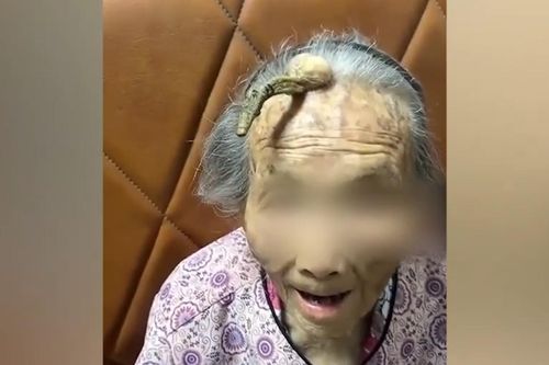 Cụ bà 107 tuổi tại Trung Quốc sở hữu chiếc 'sừng trường thọ'