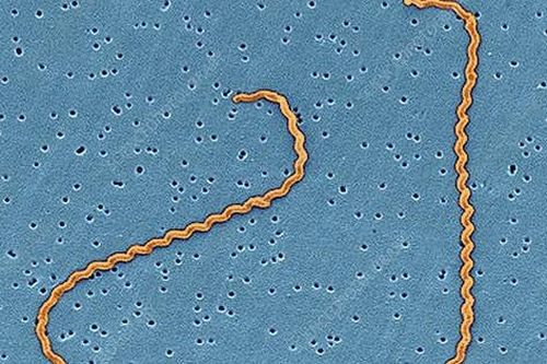 Nhiễm xoắn khuẩn Leptospira có biểu hiện như thế nào?