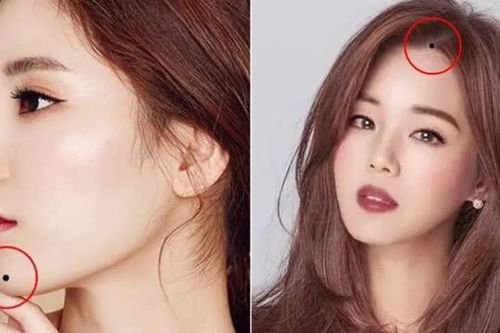 Nếu có những nốt ruồi ở vị trí này, đừng vội tẩy xóa, sau 35 tuổi sẽ giàu sang vượng phát
