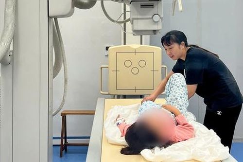Bệnh nhi gãy xương đùi được phẫu thuật bằng phương pháp ít xâm lấn