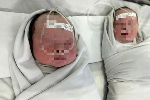 Báo động đỏ toàn viện, cứu sản phụ mang song thai nguy kịch