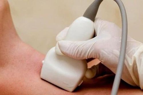 Bộ Y tế phản bác thông tin sử dụng thực phẩm bổ sung I-ốt gây cường giáp