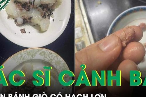 Xôn xao nhân bánh giò có hạch lợn, bác sĩ cảnh báo