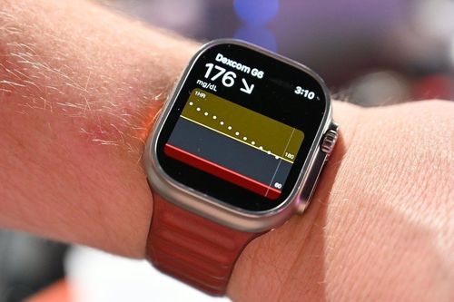 App sức khỏe mới đang được Apple nghiên cứu