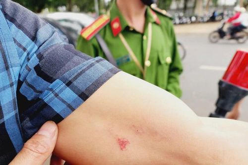 Phóng viên Báo Công an Nhân dân bị đánh, tịch thu máy ảnh