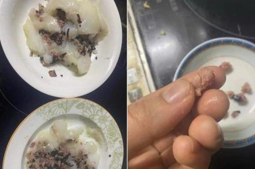 Xôn xao phát hiện hạch lợn trong nhân bánh giò: Bác sĩ nói gì?