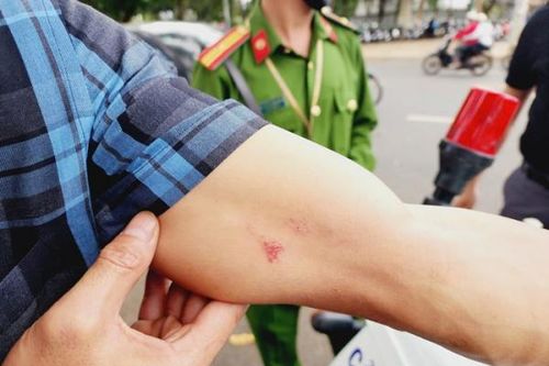 Thông tin ban đầu về việc phóng viên Báo CAND bị hành hung khi tác nghiệp