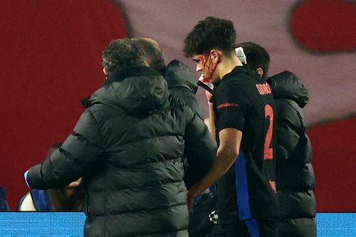 Bức ảnh gây sốc của sao trẻ Barca