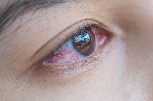 Dấu hiệu chứng tỏ bạn nhiễm giun đũa chó mèo