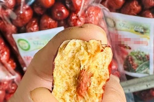 Cấp cứu sau khi ăn táo đỏ