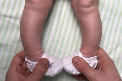Tin tức Đời sống 7/11: Nhận biết dấu hiệu trẻ thiếu canxi để ngừa biến chứng lâu dài