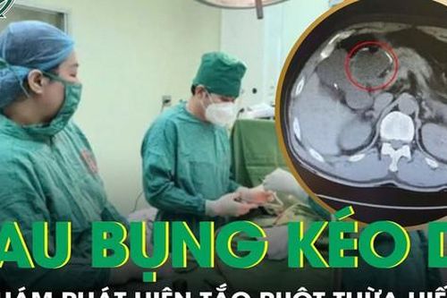 Đau bụng kéo dài, đi khám phát hiện tắc ruột thừa hiếm gặp