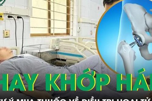 Người đàn ông 40 tuổi phải thay khớp háng vì tự ý dùng thuốc nam