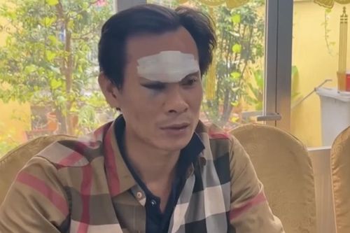 Khởi tố đối tượng tấn công CSGT khi đang làm nhiệm vụ