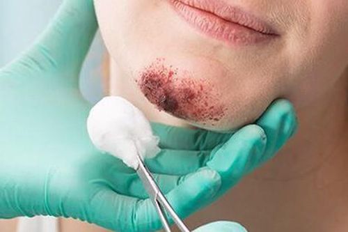 8 câu hỏi thường gặp về chấn thương hàm mặt