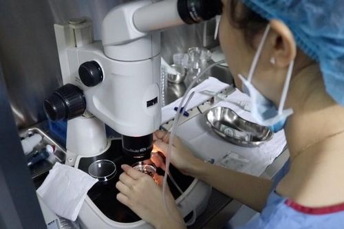 Suy giảm dự trữ buồng trứng ở người trẻ
