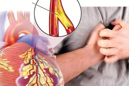 Hút thuốc lá là tác nhân gây nên nhiều bệnh về tim mạch