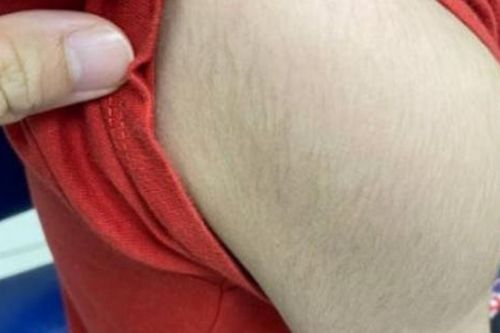 Mọc lông khắp người sau 3 tháng tự dùng thuốc gia truyền để tăng cân