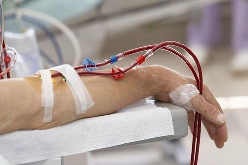 Lọc máu có phòng ngừa được đột quỵ?