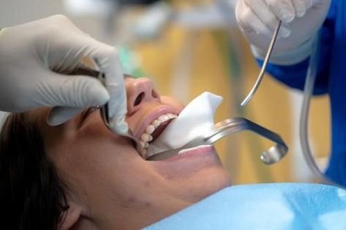 8 nguyên nhân khiến răng mọc lệch ai cũng cần biết
