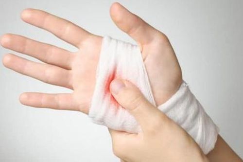 Cách sơ cứu cầm máu đúng theo khuyến cáo của bác sĩ