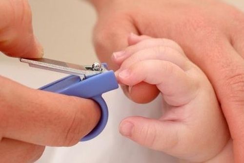 Bé 1 tháng tuổi nguy kịch sau khi cắt móng tay