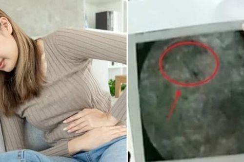 Bị đau suốt 18 năm từ sau khi sinh con, người phụ nữ phát hiện ra vấn đề bất ngờ