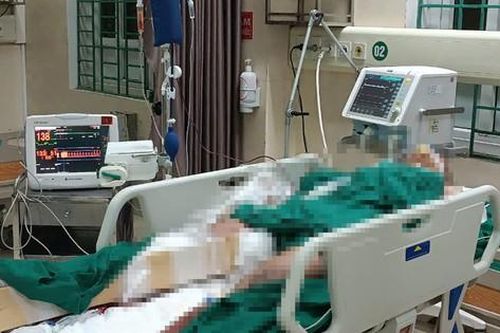 Kính 3 tầng nhà vỡ vụn, một thanh niên trọng thương sau tiếng nổ lớn