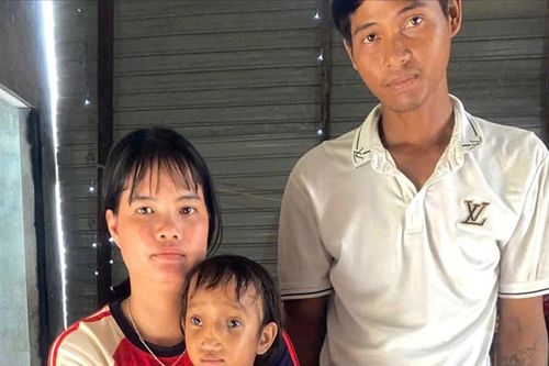 Cháu bé mắc bệnh thoát vị não cần được giúp đỡ