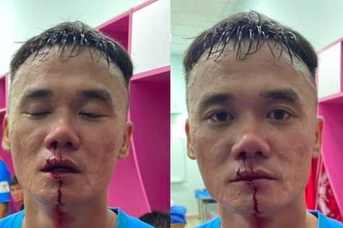 VFF phạt nặng hai cầu thủ đánh nhau ở giải hạng Nhất