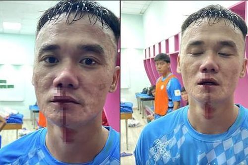 Phạt cực nặng Xuân Nam và Văn Sơn