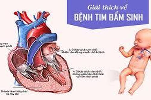 Mẹ bầu bị tiểu đường, con có bị tim bẩm sinh không?