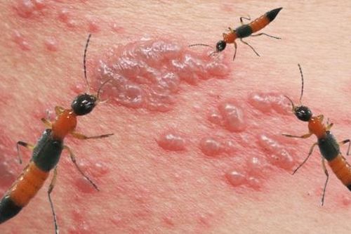 Cuộc sống đảo lộn vì đợt 'càn quét' của loài kiến có độc tố gấp 15 lần rắn hổ mang