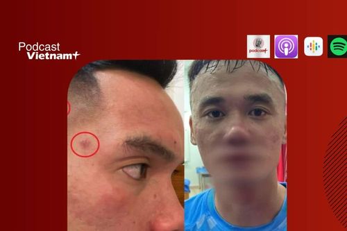 VFF chính thức ra án phạt thích đáng với vụ ẩu đả tại giải hạng Nhất quốc gia
