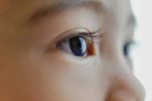 Ăn quá nhiều đồ ăn vặt kém dinh dưỡng, cậu bé 12 tuổi bị mất thị lực vĩnh viễn