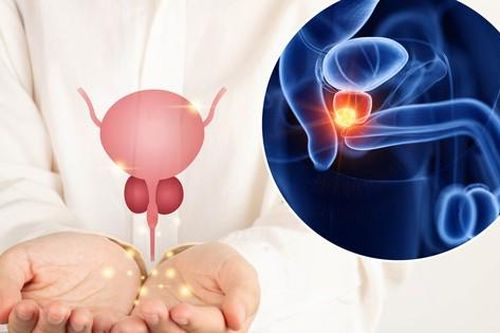 Khi nào nam giới nên tầm soát ung thư tuyến tiền liệt?