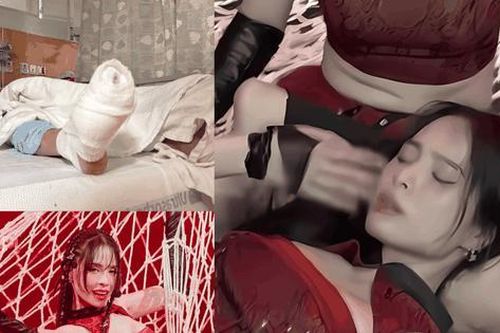 Chấn thương của ca nương Kiều Anh và những sự cố gây ám ảnh làng giải trí Việt