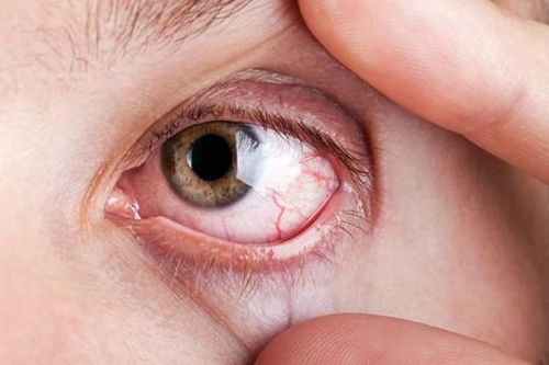 Thuốc dùng trong điều trị Hội chứng Sjogren