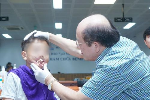Hiệu quả của tạo hình vi phẫu trong điều trị tổn thương lớn, phức tạp vùng mặt