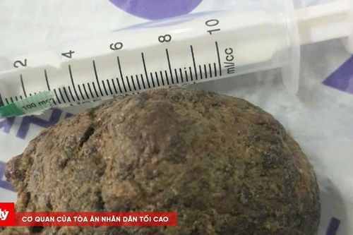 Người đàn ông phải phẫu thuật mở dạ dày do ăn quả hồng ngâm