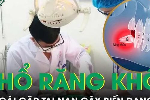 Cô gái ngã biến dạng mặt nghiêm trọng vì choáng ngất sau nhổ răng khôn