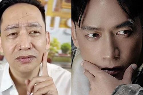 'Nối gót' đàn anh Ngọc Sơn, Duy Mạnh đi sửa 2 bộ phận trên mặt