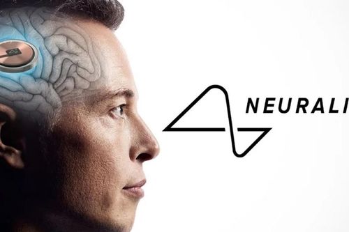 Canada cho phép Neuralink thử nghiệm cấy chip vào não người
