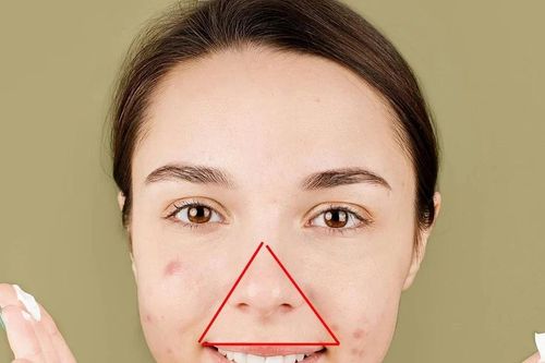 Giải mã bí ẩn về vùng 'tam giác tử thần' trên gương mặt mỗi người