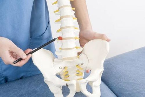 Triệu chứng của xẹp đốt sống do loãng xương